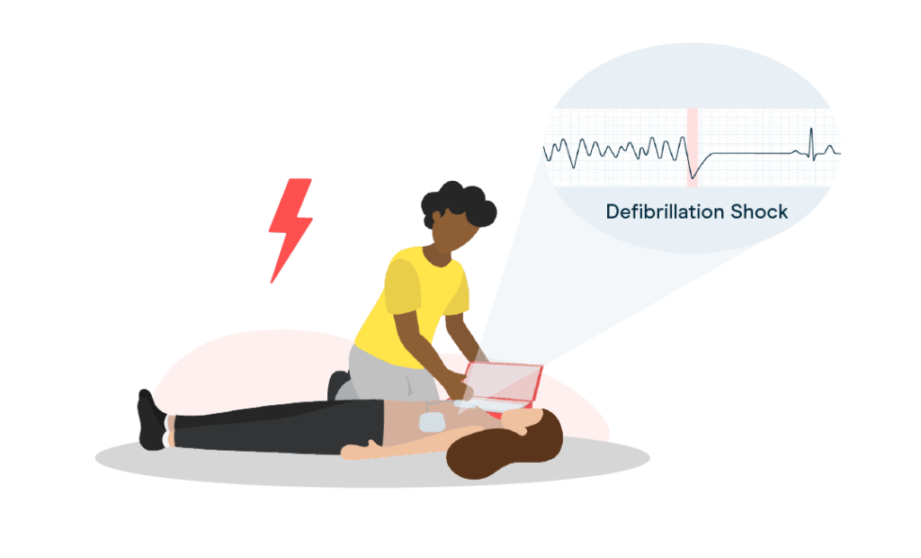 A Women is giving defibrillation shock to an underlying women Small