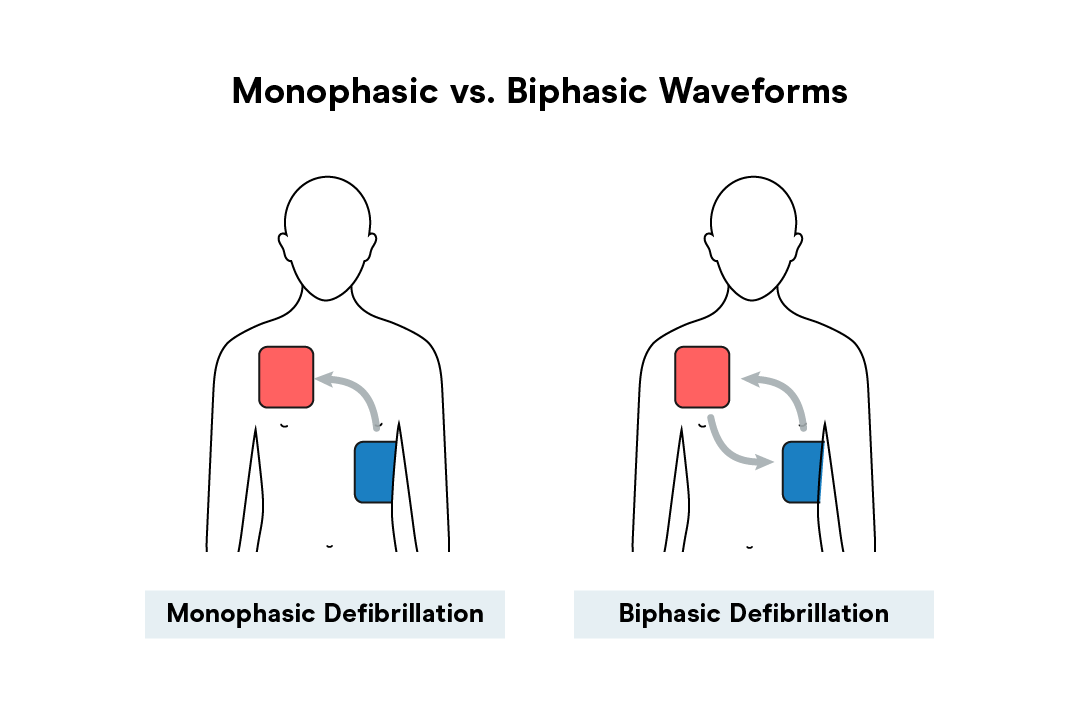 Monophasic vs. Biphasic Shocks - What's the Difference